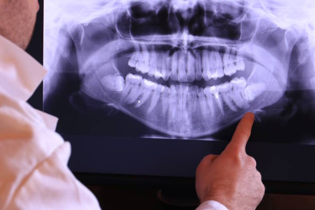 Best Emergency Broken Tooth Repair in Worcester, MA