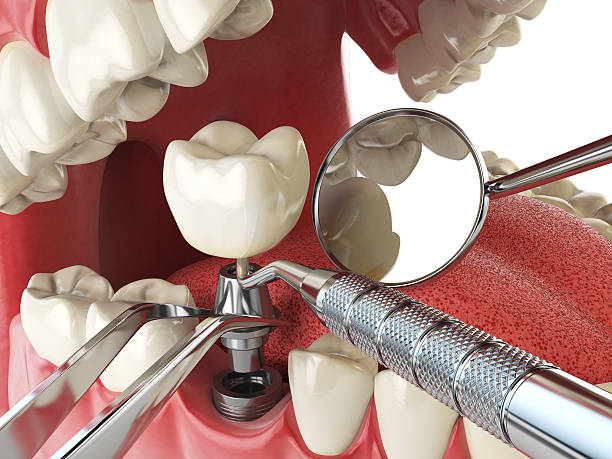 Fast & Reliable Emergency Dental Services in MA